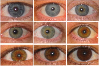 A cor do olho também pode ficar mais clara com o passar do tempo, pois vai acontecendo a perda de melanina. 
